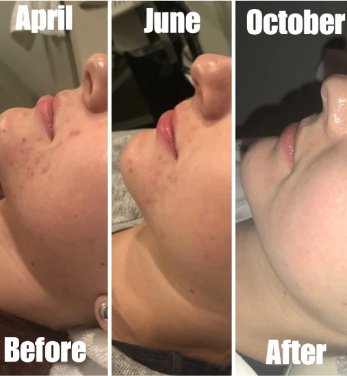 Instagram Feed Six in Arizona at Pure Vanity Spa